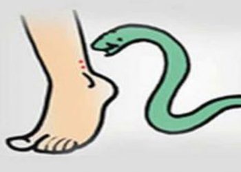 सर्पदंश व त्यावरील उपाय…
