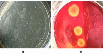 सेल्युलोज – टाकाऊ पदार्थापासून कार्बन विलग करणारा जिवाणू